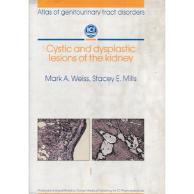 Cystic and dysplastic lesions of the kidney